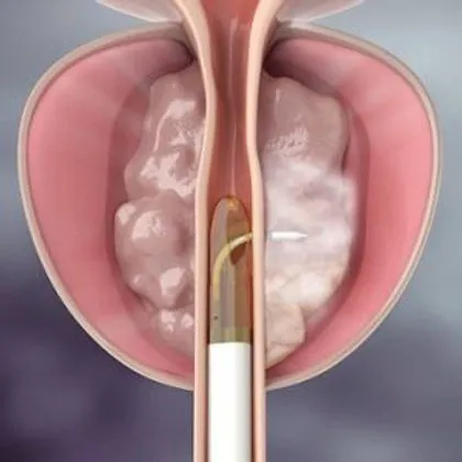Clinician reviewing prostate imaging