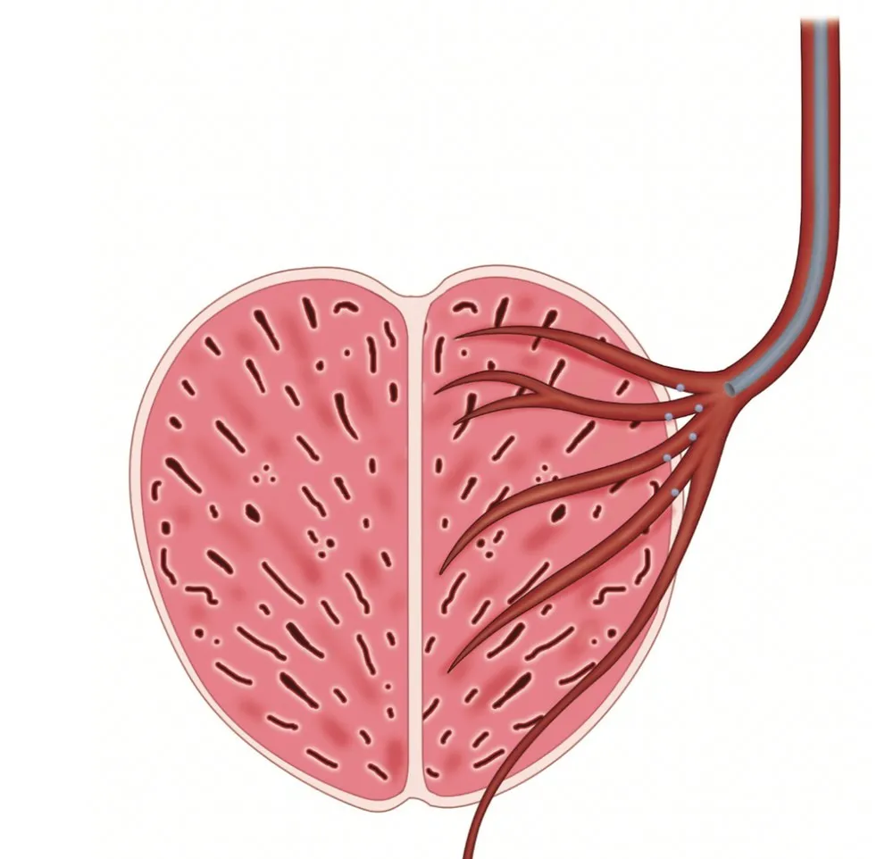 Illustration of the prostate and its arteries